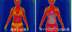 thermography